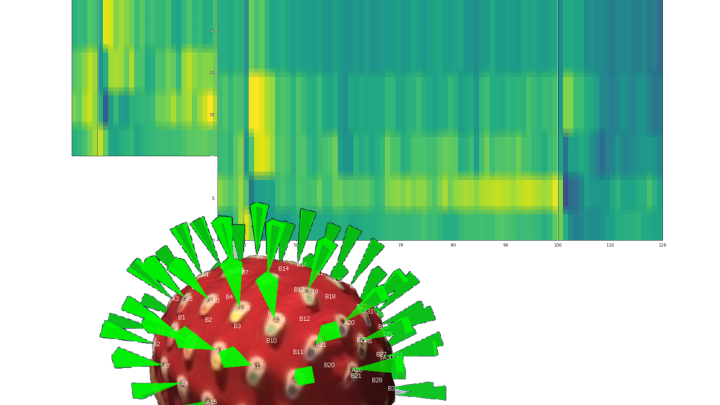 tinnitus